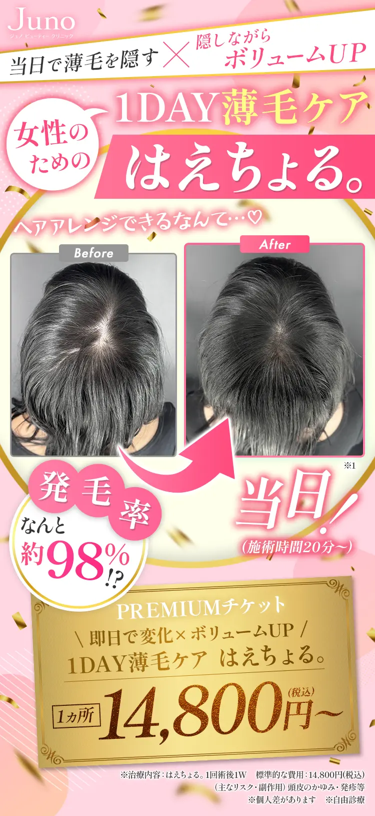 当日で薄毛を隠す×隠しながらボリュームUP 女性のための1DAY薄毛ケアはえちょる。