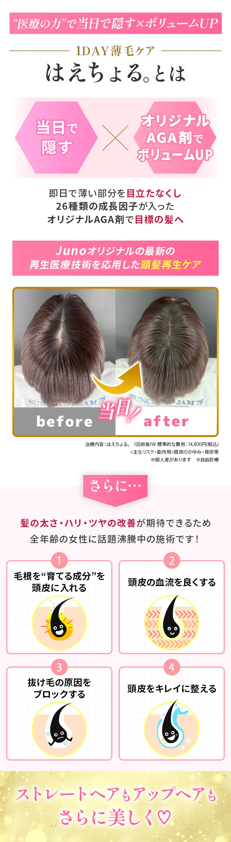 はえちょる。とは